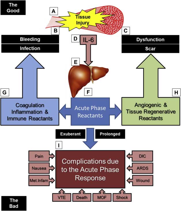 Acute Phase Response The Schoenecker Laboratory