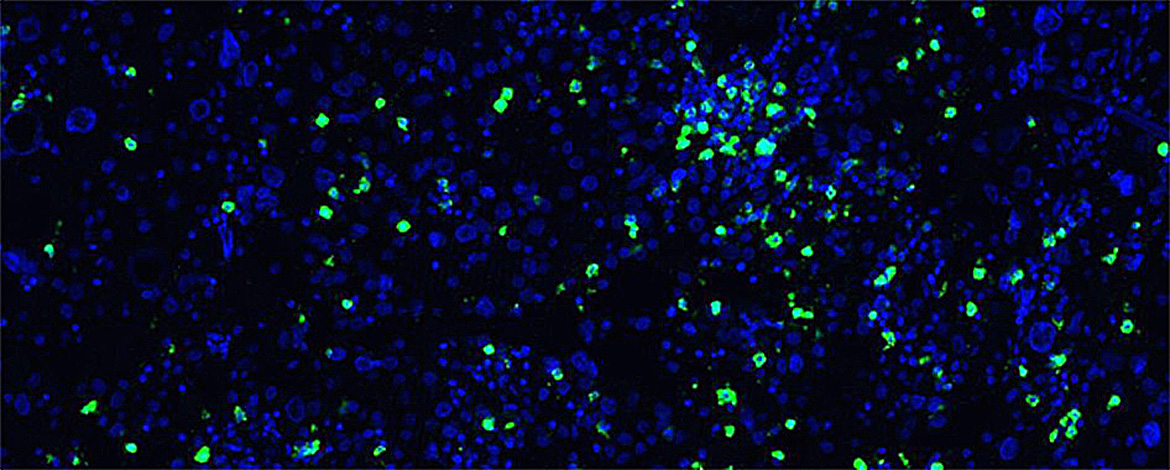 Tumor Immunology.jpg